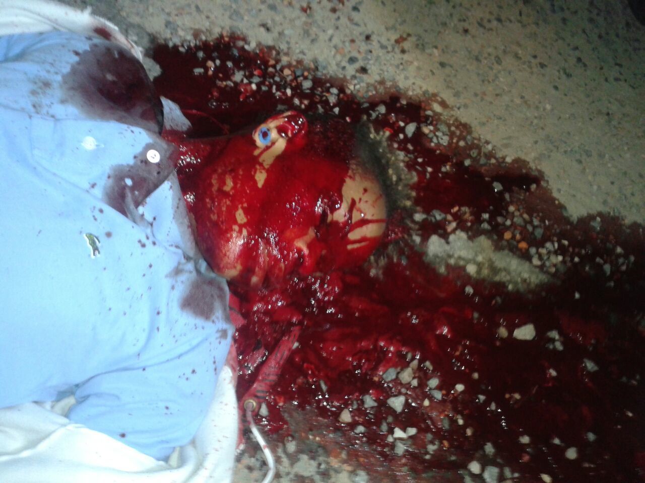 2morto-areia