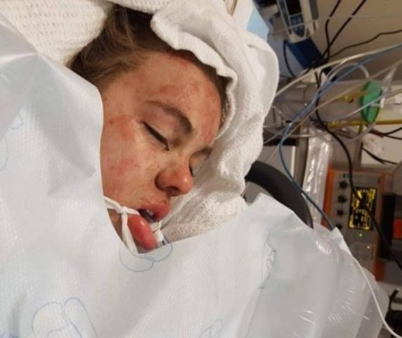 Mãe mostra foto da filha em coma para fazer alerta: "É o que o ecstasy faz"