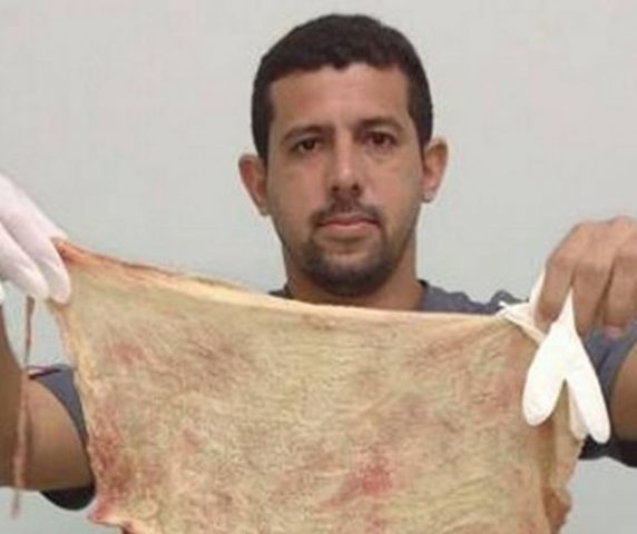 Mãe que descobriu tampão 21 dias após parto relata desespero: "Cheiro horrível"