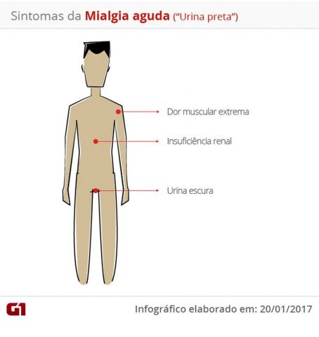 'Doença da urina preta' foi causada por intoxicação após ingestão de peixe, diz estudo