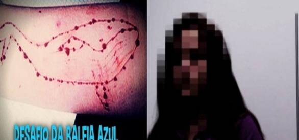 Feira de Santana: adolescente faz cortes nos braços após jogar ‘Baleia Azul’