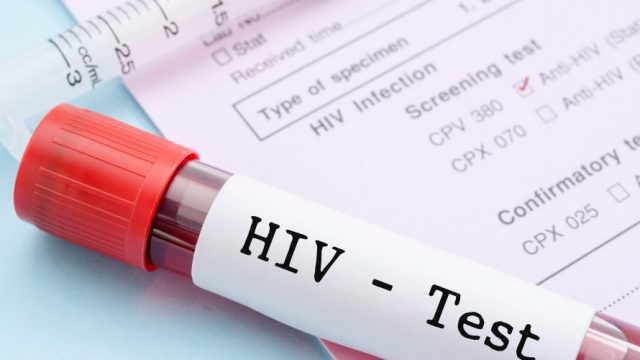 Segundo estudos, soropositivos com carga viral indetectável não transmitem HIV