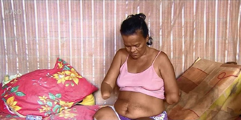 Mulher sem mãos tem pedido de benefício negado pelo INSS por não poder assinar papel