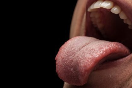 Cuidado na hora de beijar! Novo coronavírus se replica em glândulas salivares, aponta estudo da USP