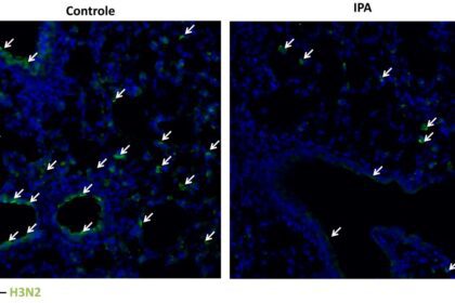 Estudo aponta que molécula produzida no intestino pode proteger contra gripe