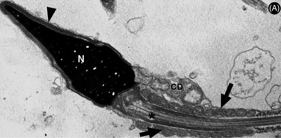 Estudo aponta que o coronavírus pode ser detectado em espermatozoides por até 110 dias pós-infecção