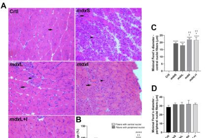 Nova estratégia para minimizar evolução da distrofia muscular de Duchenne: Grupo realizou testes promissores