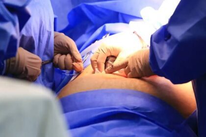 Congresso sobre transplante de órgãos em Salvador começa na quarta-feira (5)