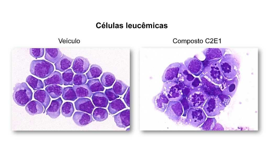 Potencial da molécula para combater a leucemia em testes pré-clínicos