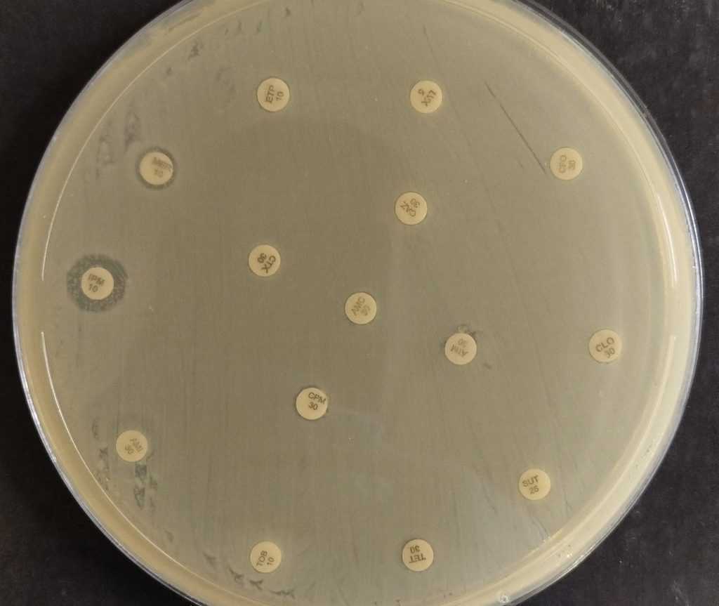 Bactéria multirresistente de alto risco detectada no Nordeste preocupa autoridades de saúde mundial